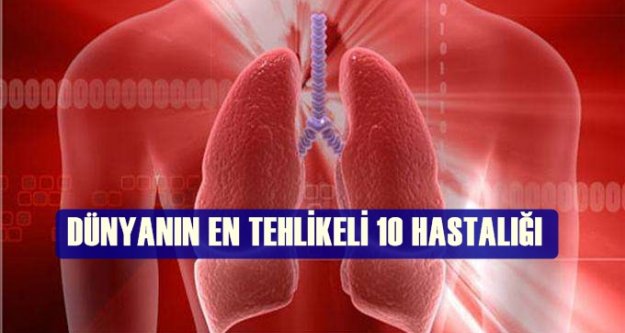 DÜNYANIN EN TEHLİKELİ 1O HASTALIĞI